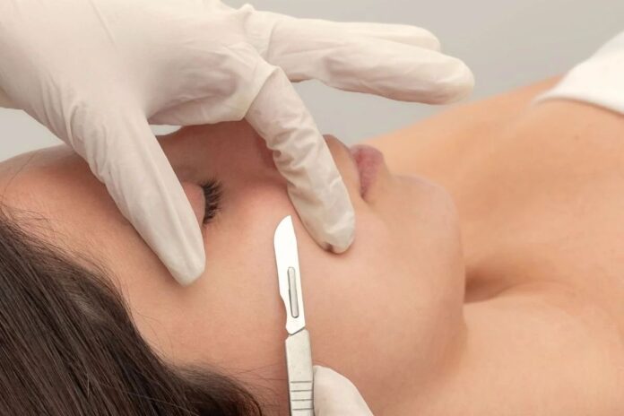 Dermaplaning – Remove Peach Fuzz Instantly