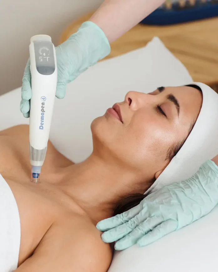 Microneedling – Collagen Boost for Scars